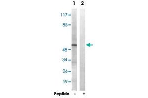 Western blot analysis of extracts from HT-29 cells, using APLF polyclonal antibody . (APLF 抗体  (Ser116))