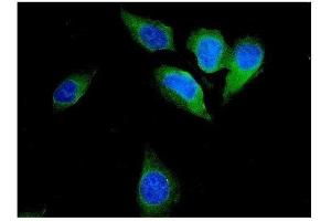 IF analysis of FHIT using anti-FHIT antibody (ABIN3042392). (FHIT 抗体  (AA 1-147))