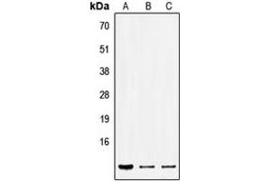 Western blot analysis of SEC61B expression in HEK293T (A), Raw264. (SEC61B 抗体  (Center))