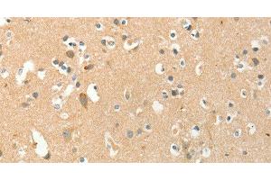 Immunohistochemistry of paraffin-embedded Human brain tissue using AANAT Polyclonal Antibody at dilution 1:40 (AANAT 抗体)