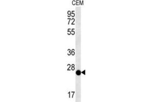 Western Blotting (WB) image for anti-Cysteine-Rich Secretory Protein LCCL Domain Containing 2 (CRISPLD2) antibody (ABIN3002383)