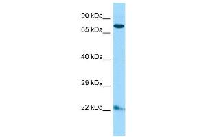 Host:  Rabbit  Target Name:  Zfp74  Sample Type:  Mouse Lung lysates  Antibody Dilution:  1. (ZNF74 抗体  (C-Term))