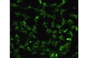 Immunofluorescence (IF) image for anti-Carbonic Anhydrase IX (CA9) (AA 113-143) antibody (ABIN3028531)