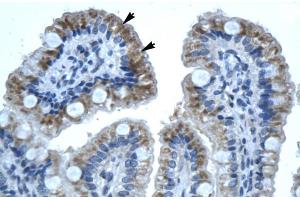 Human Intestine (GJB1 抗体  (C-Term))
