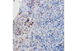 Immunohistochemistry of paraffin-embedded human tonsil using IL17A Rabbit pAb (ABIN6128129, ABIN6142315, ABIN6142317 and ABIN6216088) at dilution of 1:200 (40x lens). (Interleukin 17a 抗体  (AA 24-155))