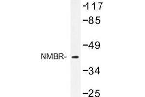 Image no. 1 for anti-Neuromedin B Receptor (NMBR) antibody (ABIN317709) (NMBR 抗体)