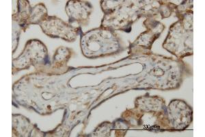 Immunoperoxidase of monoclonal antibody to SLK on formalin-fixed paraffin-embedded human placenta. (SLK 抗体  (AA 1126-1235))