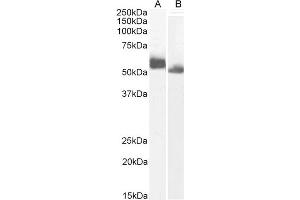 (ABIN6391353) (0. (IRF4 抗体  (AA 393-407))