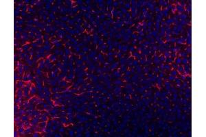 IF analysis of TAPA1/CD81 using anti-TAPA1/CD81 antibody (ABIN5693258).