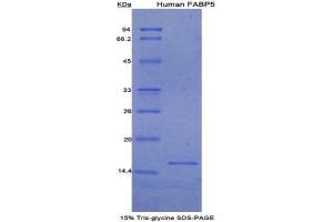 SDS-PAGE (SDS) image for Fatty Acid Binding Protein 5 (Psoriasis-Associated) (FABP5) (AA 2-135) protein (His tag) (ABIN1079486) (FABP5 Protein (AA 2-135) (His tag))