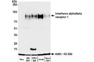 Western Blotting (WB) image for anti-Interferon alpha/beta Receptor 1 (IFNAR1) (AA 27-436) antibody (ABIN7795661)