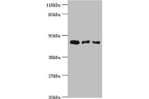 Western blot All lanes: Calreticulin-3 antibody at 4 μg/mL Lane 1: Hela whole cell lysate Lane 2: HepG2 whole cell lysate Lane 3: Rat gonad tissue Secondary Goat polyclonal to rabbit IgG at 1/10000 dilution Predicted band size: 45 kDa Observed band size: 45 kDa (Calreticulin 3 抗体  (AA 135-384))