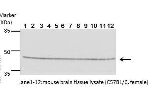 Western Blotting (WB) image for anti-Creatine Kinase, Brain (CKB) antibody (ABIN2855158)