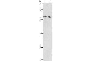 Gel: 10 % SDS-PAGE, Lysate: 40 μg, Lane 1-2: Human liver cancer tissue, Human fetal liver tissue, Primary antibody: ABIN7192673(STEAP4 Antibody) at dilution 1/450, Secondary antibody: Goat anti rabbit IgG at 1/8000 dilution, Exposure time: 40 seconds (STEAP4 抗体)