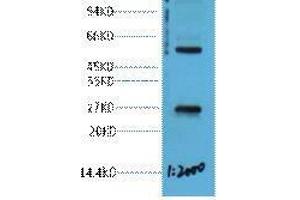 Western Blot (WB) analysis of 293T cell lysate, diluted at 1:2000. (EFHD1 抗体)