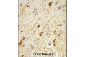 Formalin-fixed and paraffin-embedded human brain tissue reacted with QDPR Antibody (C-term), which was peroxidase-conjugated to the secondary antibody, followed by DAB staining. (QDPR 抗体  (C-Term))