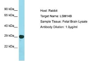 Host: Rabbit Target Name: LSM14B Sample Type: Fetal Brain lysates Antibody Dilution: 1.