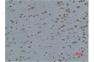 Immunohistochemistry (IHC) image for anti-Calcium Channel, Voltage-Dependent, gamma Subunit 4 (CACNG4) antibody (ABIN3181550)