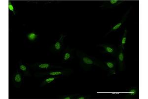 Immunofluorescence of monoclonal antibody to FASTK on HeLa cell.