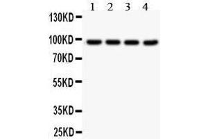 Western Blotting (WB) image for anti-Solute Carrier Family 6 (Neurotransmitter Transporter, serotonin), Member 4 (SLC6A4) (AA 57-85), (N-Term) antibody (ABIN3043931)