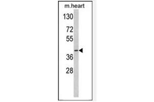 Image no. 3 for anti-Medium-Chain Specific Acyl-CoA Dehydrogenase, Mitochondrial (MCAD) (AA 196-225) antibody (ABIN452704) (Medium-Chain Specific Acyl-CoA Dehydrogenase, Mitochondrial (MCAD) (AA 196-225) 抗体)