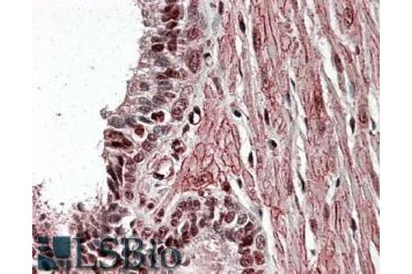 ZNF217 抗体  (Internal Region)