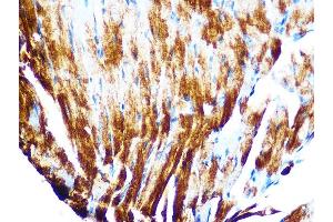 Immunohistochemistry of paraffin-embedded mouse heart using Cardiac Cardiac troponin T (TNNT2) (TNNT2) Rabbit mAb (ABIN7266088) at dilution of 1:100 (40x lens). (Cardiac Troponin T2 抗体)