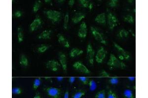 Immunofluorescence analysis of U-2 OS cells using APOB Polyclonal Antibody at dilution of 1:100. (APOB 抗体)