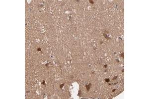 Immunohistochemical staining of human cerebral cortex with STAP2 polyclonal antibody  shows strong cytoplasmic positivity in neuronal cells. (STAP2 抗体)