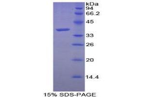SDS-PAGE analysis of Human Calcineurin Protein. (CAN 蛋白)