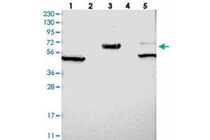 Western blot analysis of Lane 1: RT-4, Lane 2: U-251 MG, Lane 3: Human Plasma, Lane 4: Liver, Lane 5: Tonsil with WSCD2 polyclonal antibody . (WSCD2 抗体)