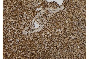 ABIN6279422 at 1/100 staining Mouse spleen tissue by IHC-P. (EIF3A 抗体  (C-Term))