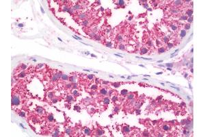 Anti-TNFRSF1A / TNFR1 antibody IHC staining of human testis.