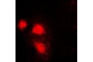 Immunofluorescent analysis of eIF3E staining in Hela cells. (EIF3E 抗体)