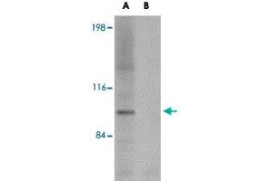 Western blot analysis of NLRP3 in K-562 cell lysate with NLRP3 polyclonal antibody  at 1 ug/mL (A) in the absence and (B) in the presence of blocking peptide. (NLRP3 抗体  (AA 120-170))