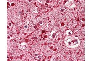 Anti-ASCL3 antibody IHC of human brain, cortex. (ASCL3 抗体  (AA 118-130))