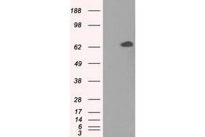 Image no. 2 for anti-Glucose-6-Phosphate Isomerase (GPI) antibody (ABIN1498505) (GPI 抗体)
