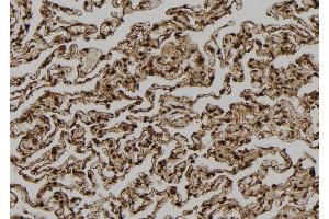 ABIN6272867 at 1/100 staining Human lung tissue by IHC-P. (TPI1 抗体  (C-Term))