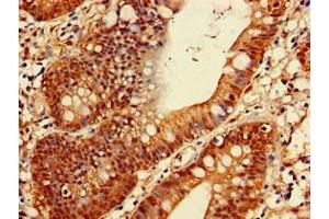 Immunohistochemistry (IHC) image for anti-Proteasome Subunit alpha Type 1 (PSMA1) (AA 163-263) antibody (ABIN7164944)