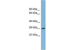 WB Suggested Anti-MPZL2 Antibody Titration:  0.