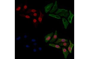ABIN6254899 and ABIN6267063 staining HepG2 cells(30 min of 4uM Forskolin treatment) by IF/ICC.