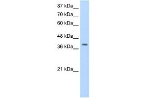 WB Suggested Anti-LAntibody Titration:  1. (LARP7 抗体  (C-Term))