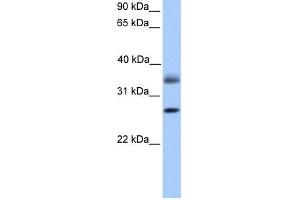 WB Suggested Anti-LGALS8 Antibody Titration: 0. (LGALS8 抗体  (C-Term))