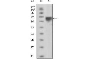Western blot analysis using TYRO3 mouse mAb against extracellular domain of human TYRO3 (aa41-429). (TYRO3 抗体)