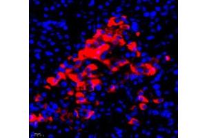 Immunofluorescence of paraffin embedded human pancreas using RBP (ABIN7075409) at dilution of 1: 650 (400x lens) (RBP4 抗体)