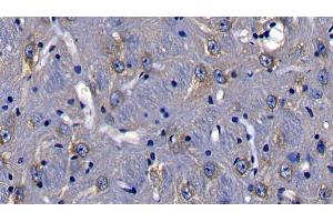Immunohistochemistry (IHC) image for anti-Toll-Interleukin 1 Receptor (TIR) Domain Containing Adaptor Protein (TIRAP) (AA 1-221) antibody (ABIN7441712)