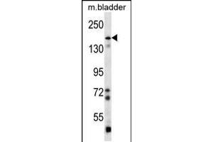 Western blot analysis in mouse bladder tissue lysates (35ug/lane). (BAI1 抗体  (C-Term))
