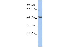 WB Suggested Anti-OLFML1 Antibody Titration: 0. (OLFML1 抗体  (Middle Region))