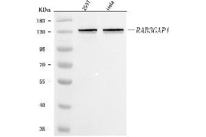 Western blot analysis of RAB3GAP1 using anti-RAB3GAP1 antibody (ABIN7599702).