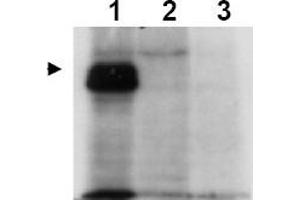 Image no. 1 for anti-MLF1 Interacting Protein (MLF1IP) (Thr78) antibody (ABIN401336) (MLF1IP 抗体  (Thr78))